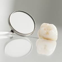 Dental crown restoration sitting on table