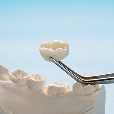 Tweezers holding a dental crown near a plaster jaw