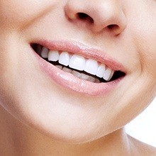 Closeup of a flawless smile after tooth colored filling restoration