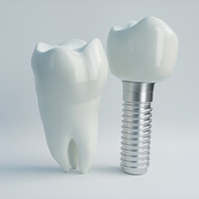 dental implant with crown next to natural tooth