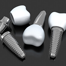 three dental implants in West Palm Beach with abutments and crowns