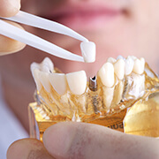 dentist placing a crown on a dental implant