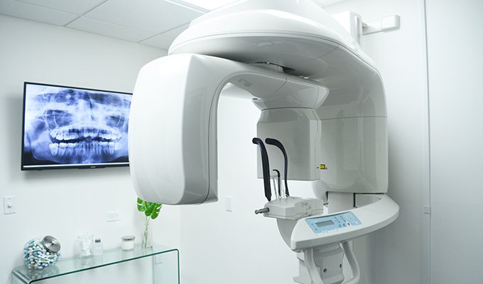3 D C T cone beam digital x-ray imaging scanner