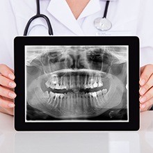 Dentist holding dental x-ray