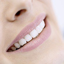 Closeup of porcelain veneer treated teeth