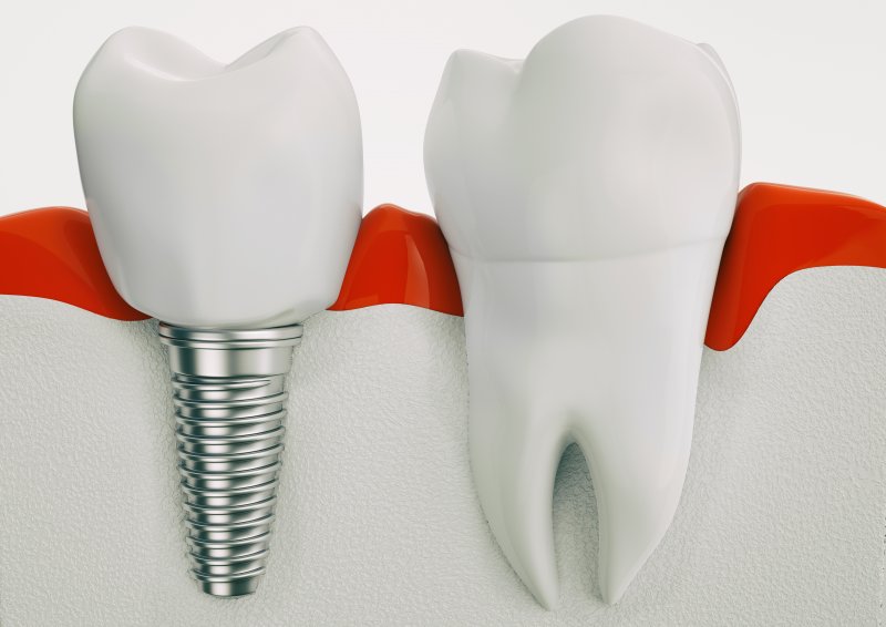 Render of dental implant next to natural tooth
