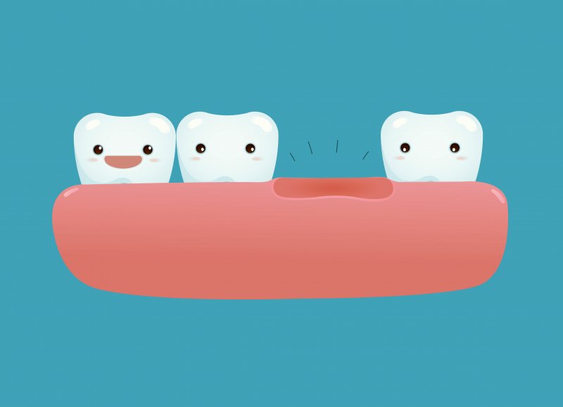 Cartoon picture of a missing tooth